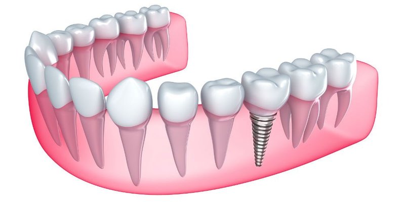 DSDentalClinic - cabinet stomatologic